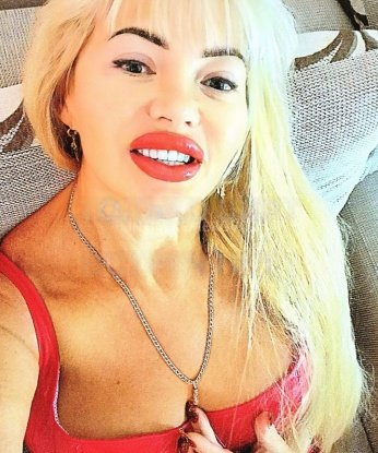 💋 милый гость! Я индивидуалка, и я та, кого ты так долго искал... Я — креативная и нежная леди, которая готова доставить тебе незабываемый опыт. Живу в Москве, так что если ты здесь, давай наслаждаться этим волшебным городом вместе.
Я предлагаю широкий спектр услуг, чтобы удовлетворить твои самые сокровенные фантазии. Будь то романтическое свидание, страстный эскорт или незабываемая ночь вместе — со мной ты найдешь все, что искал.
Мои клиенты всегда остаются довольными и возвращаются ко мне снова и снова. Они говорят, что я умею расслабить и порадовать их, предлагая комфорт и индивидуальный подход. Мои фото говорят сами за себя, и я гарантирую, что вы не останетесь равнодушным.
Возьми смелость в свои руки и дай себе возможность испытать незабываемое приключение со мной. Я готова оживить твои фантазии и сделать твои мечты реальностью. Не упускай шанс и свяжись со мной прямо сейчас. Жду тебя, чтобы создать незабываемые моменты вместе! 💖 Екатерина